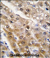 IHC-P - ALDH9A1 Antibody (N-term) AP7850a